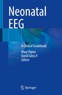 : Neonatal EEG, Buch
