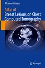 Titel: "Atlas of Breast Lesions on Chest Computed Tomography". Ein CT-Bild des Brustkorbs ist abgebildet. 