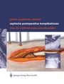 Matthias Bühler: Septische postoperative Komplikationen, Buch