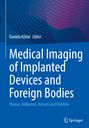 Medical Imaging of Implanted Devices and Foreign Bodies, Buch