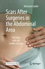 Michaela Liedler: Scars After Surgeries in the Abdominal Area, Buch