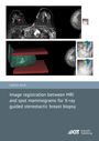 Sarah Said: Image registration between MRI and spot mammograms for X-ray guided stereotactic breast biopsy, Buch