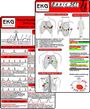 : EKG Basic Set (er Set) - Herzrhythmusstörungen, EKG Auswertung - Medizinische Taschen-Karte, Buch