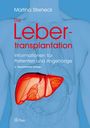 Martina Sterneck: Sterneck, M: Lebertransplantation, Buch