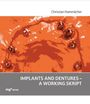 Christian Hammächer: Implants and dentures - a working skript, Buch